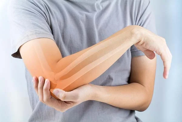 Elbow Treatment