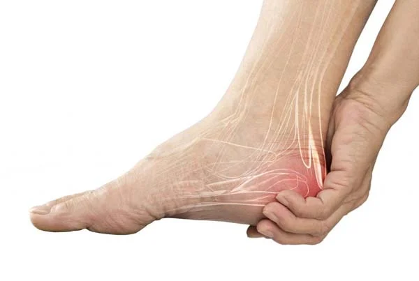 Retrocalcaneal Bursitis Treatment